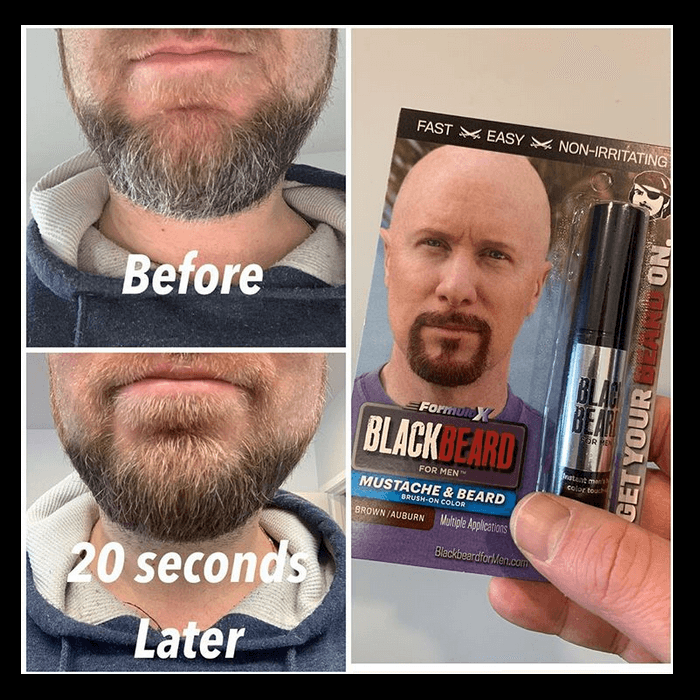 Blackbeard For Men Before & After Photo